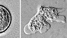 Cette image fournie par les Centers for Disease Control and Prevention montre l’amibe Naegleria fowleri à l’un des trois stades de développement.
